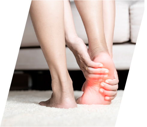 fascitis-plantar